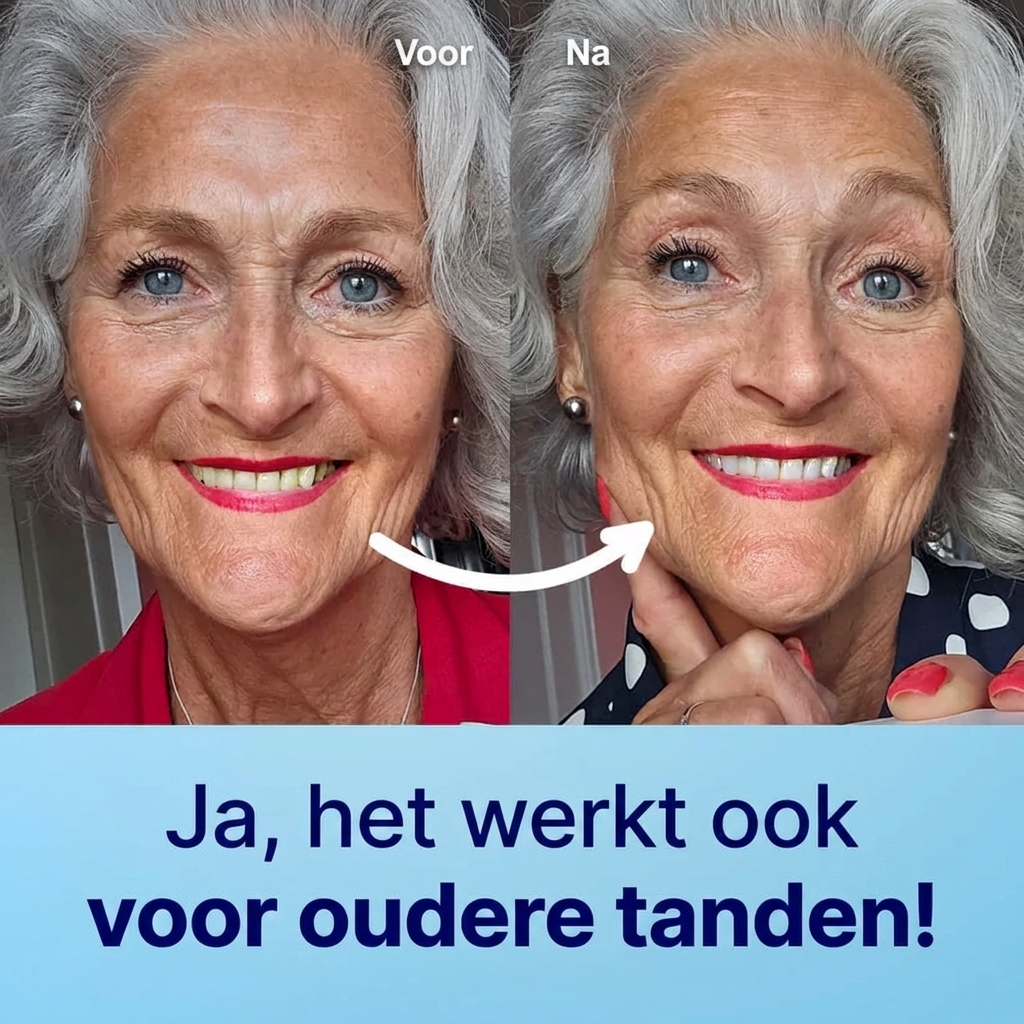 SweetSmile|  Tandpoeder voor Natuurlijk Wittere Tanden