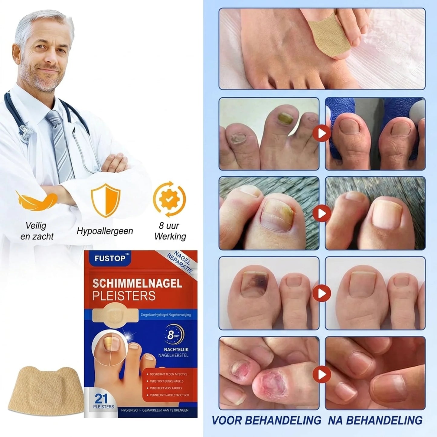 FUSTOP™ Schimmelnagelpleisters