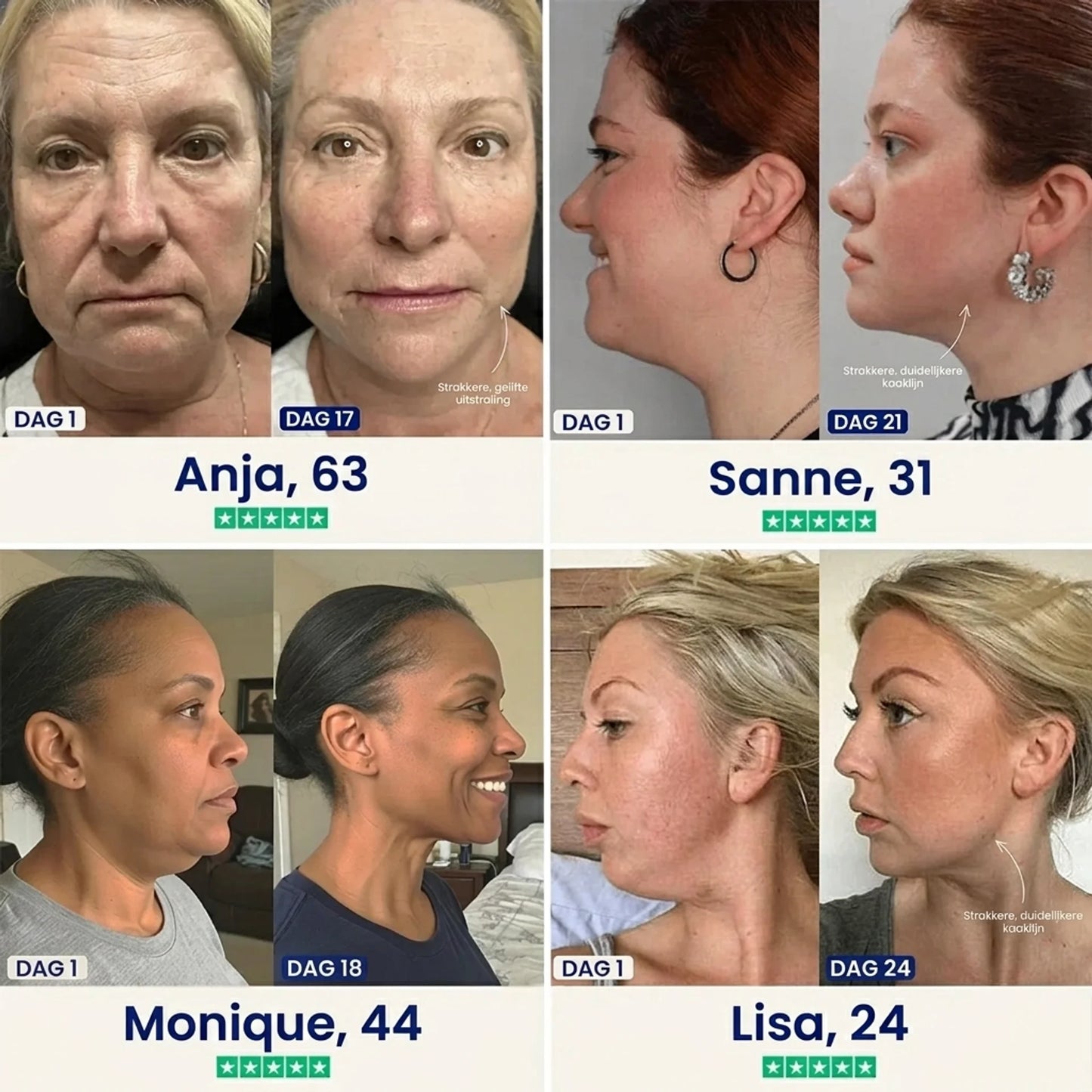 ÉLEVÉ | V-Line Lifting Mask