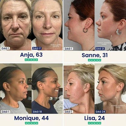 ÉLEVÉ | V-Line Lifting Mask