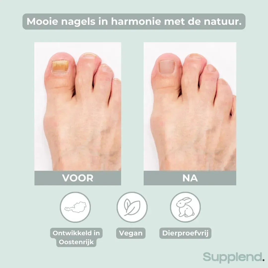 NailCare™ — Nagelverzorgingspen voor Verkleurde en Broze Nagels