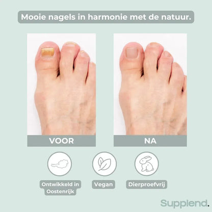NailCare™ — Nagelverzorgingspen voor Verkleurde en Broze Nagels