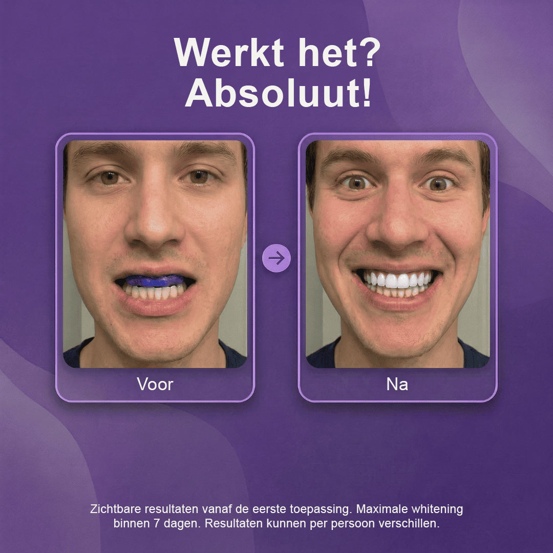 Paarse Whitening Strips