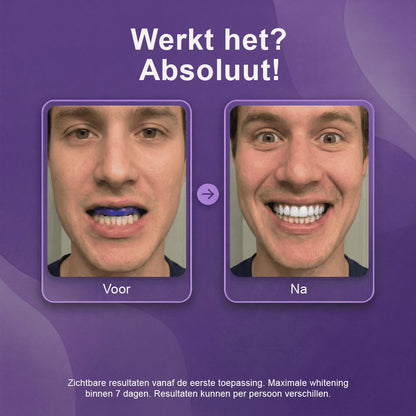 Paarse Whitening Strips