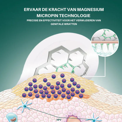 Hofstede ® Magnesium MicroPin HPV Genitale Wrat Verwijdering Patch
